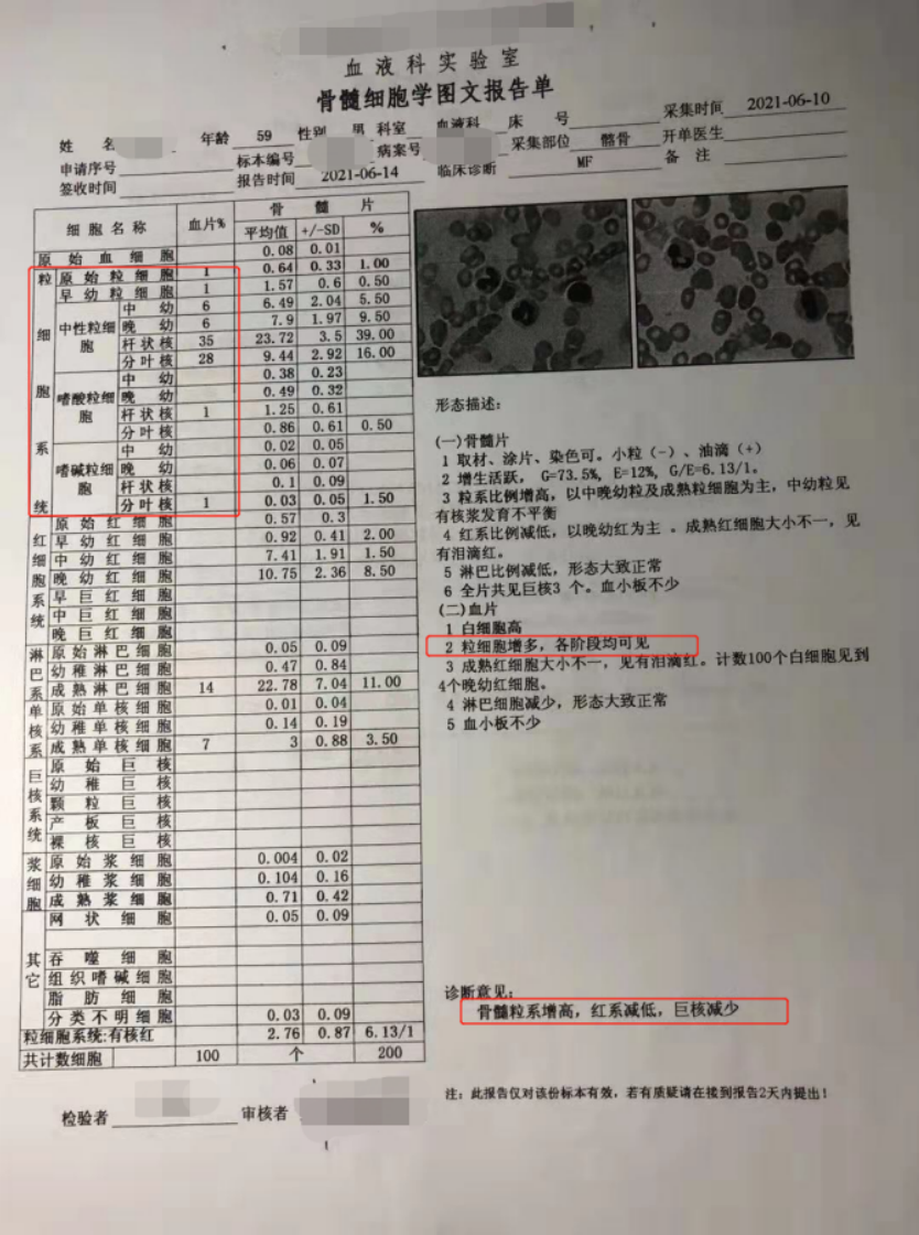 这样看骨穿报告，医生懂得您也懂