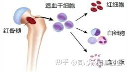 Q&A - 真性红细胞增多症多久会转变为骨髓纤维化？如何面对？