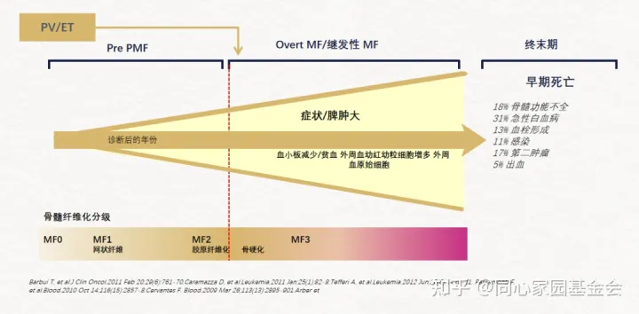 专家讲座 - 吴洁教授解析中医治疗骨髓纤维化（MF）对策（上）