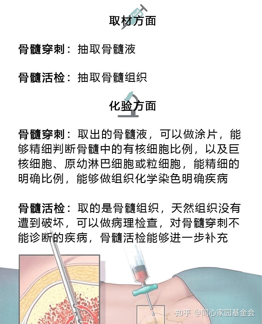 雖然骨髓穿刺和骨髓活檢都需要用穿刺針抽取骨髓部分樣本,均屬於穿刺