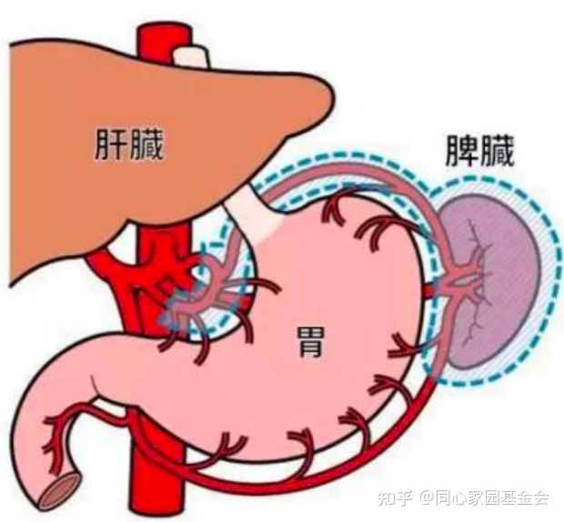 科普时间 | 脾脏“大”不如前，到底是谁惹的祸