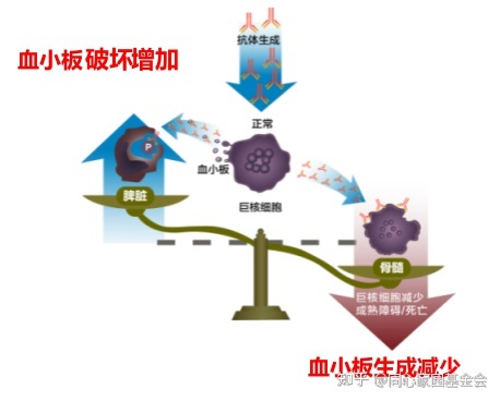 一问医答 | 原发免疫性血小板减少症（ITP）常见问题（一）