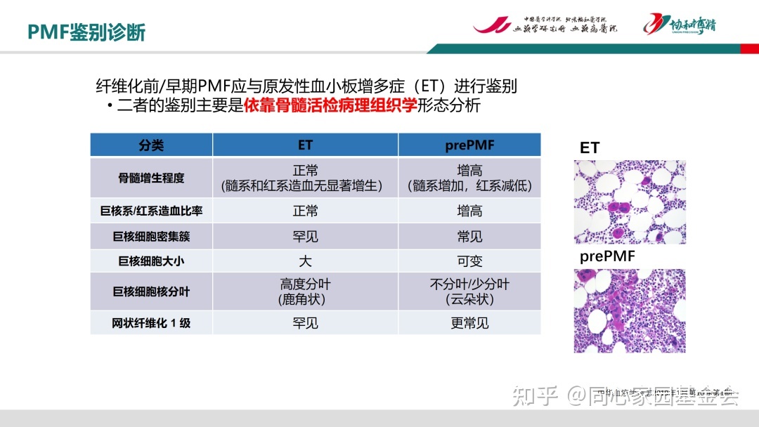 徐泽锋教授专题讲座：骨髓增殖性肿瘤（MPN）鉴别和诊断