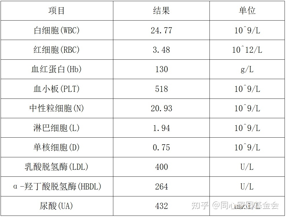 “暗藏玄机”-原发性骨髓纤维化