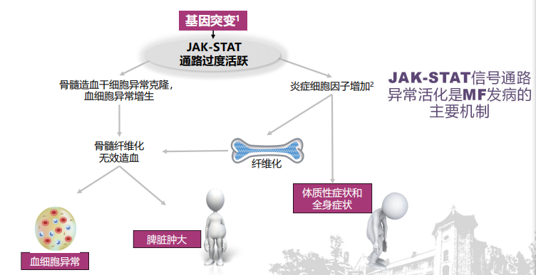 专家讲座丨陈春燕教授：骨髓纤维化（MF）的诊断和治疗