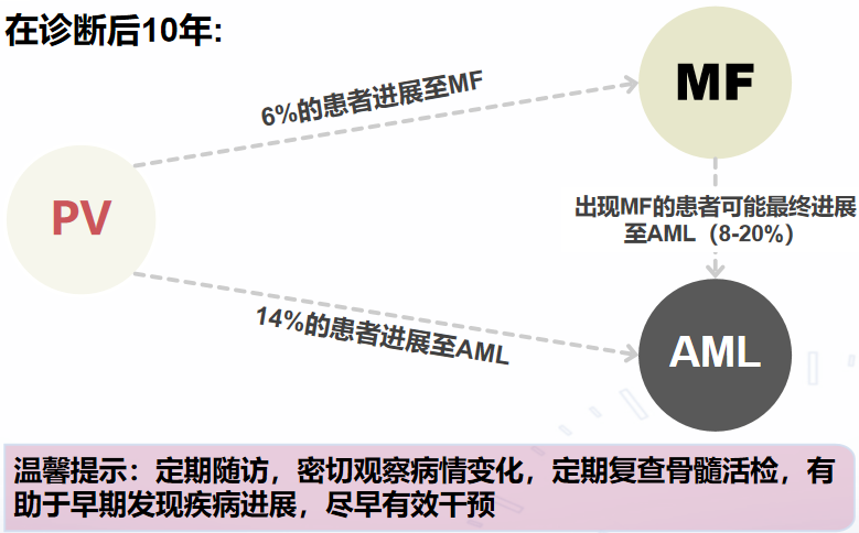 专家讲座 | 张敏教授：真性红细胞增多症 （PV）的疾病介绍及诊疗