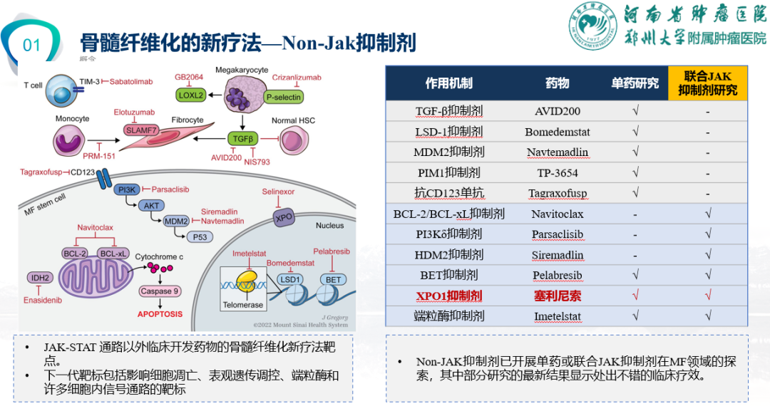 专家讲座 | 周虎教授：芦可替尼联合治疗加速期骨髓纤维化经验分享