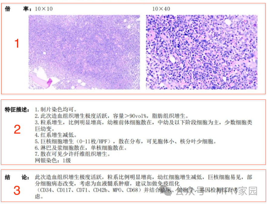 认识检查 | 骨髓活检报告如何看？