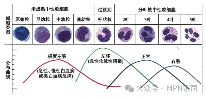 认识检查 | 骨髓活检报告如何看？