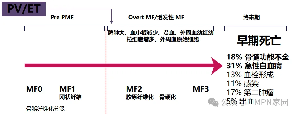 捷力呵护MF大咖谈 | “微光下的爱与希望”——让血液大咖为您揭秘骨髓纤维化治疗的曲折与奥秘