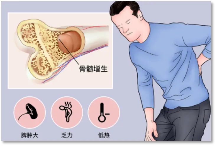 捷力呵护MF大咖谈 | 芦可替尼+X，组合拳效果惊艳——大咖带你打赢血液保卫战！