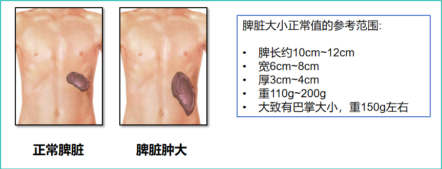 科普时间 | MPN诊断标准一览表：确诊，可不是随便“对号入座”！